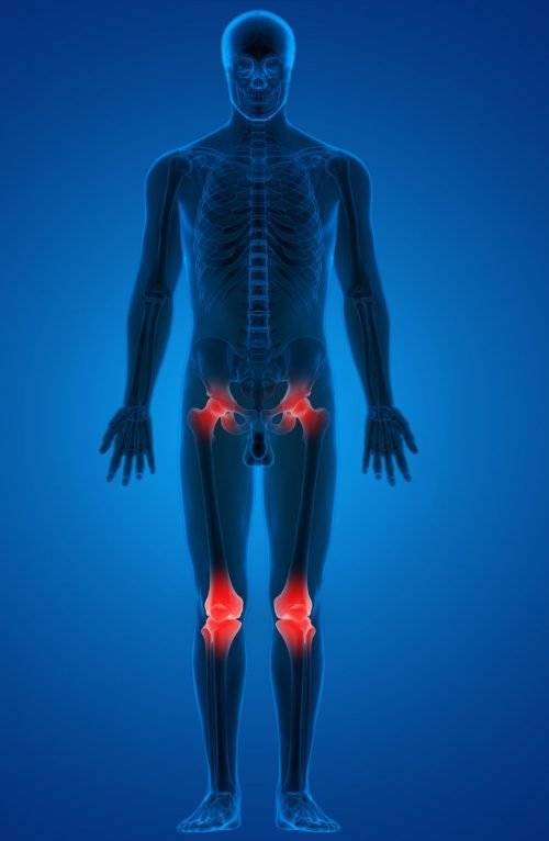 A body pictrure for electromagnetic therapy treat